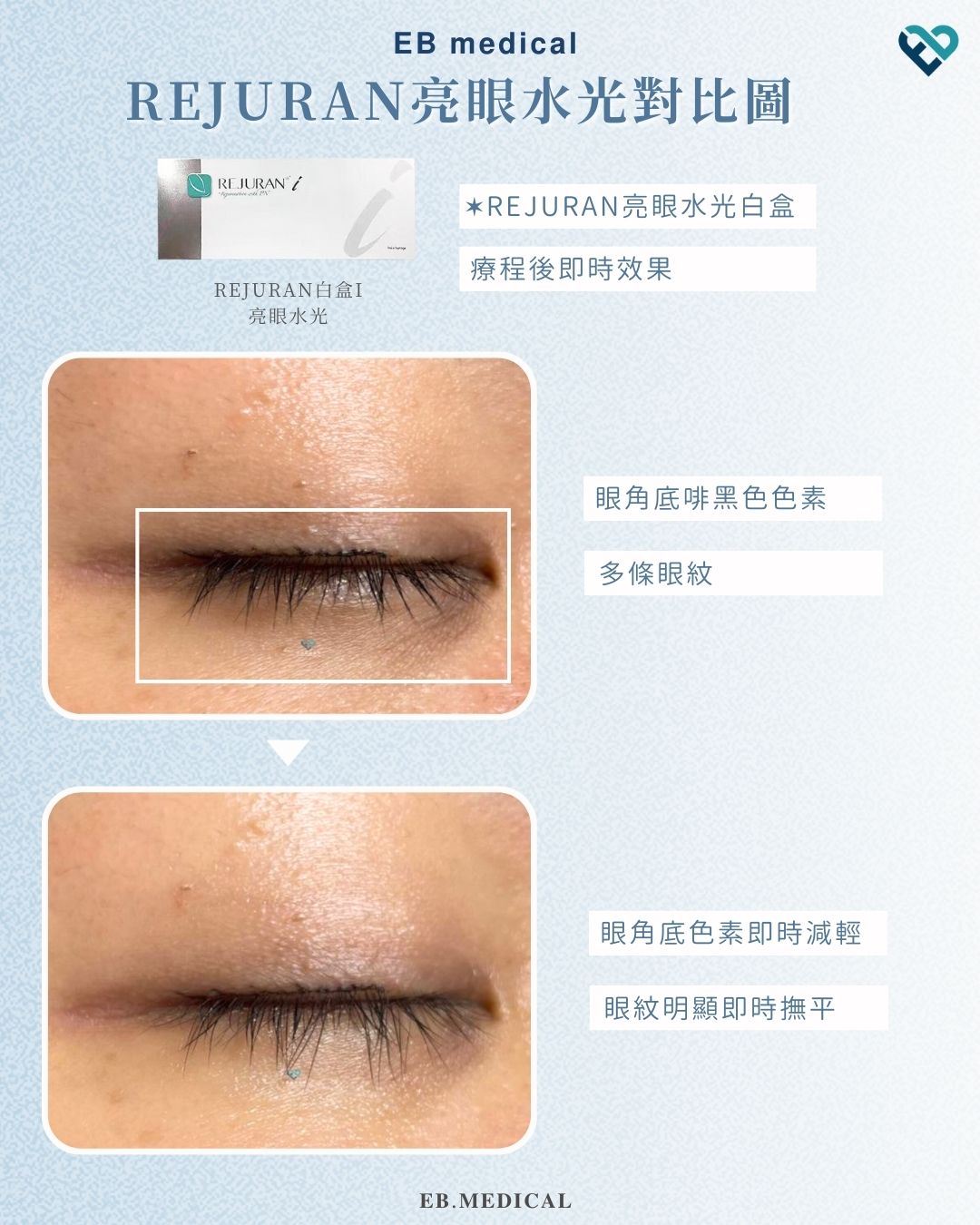 【水光針】REJURAN白盒