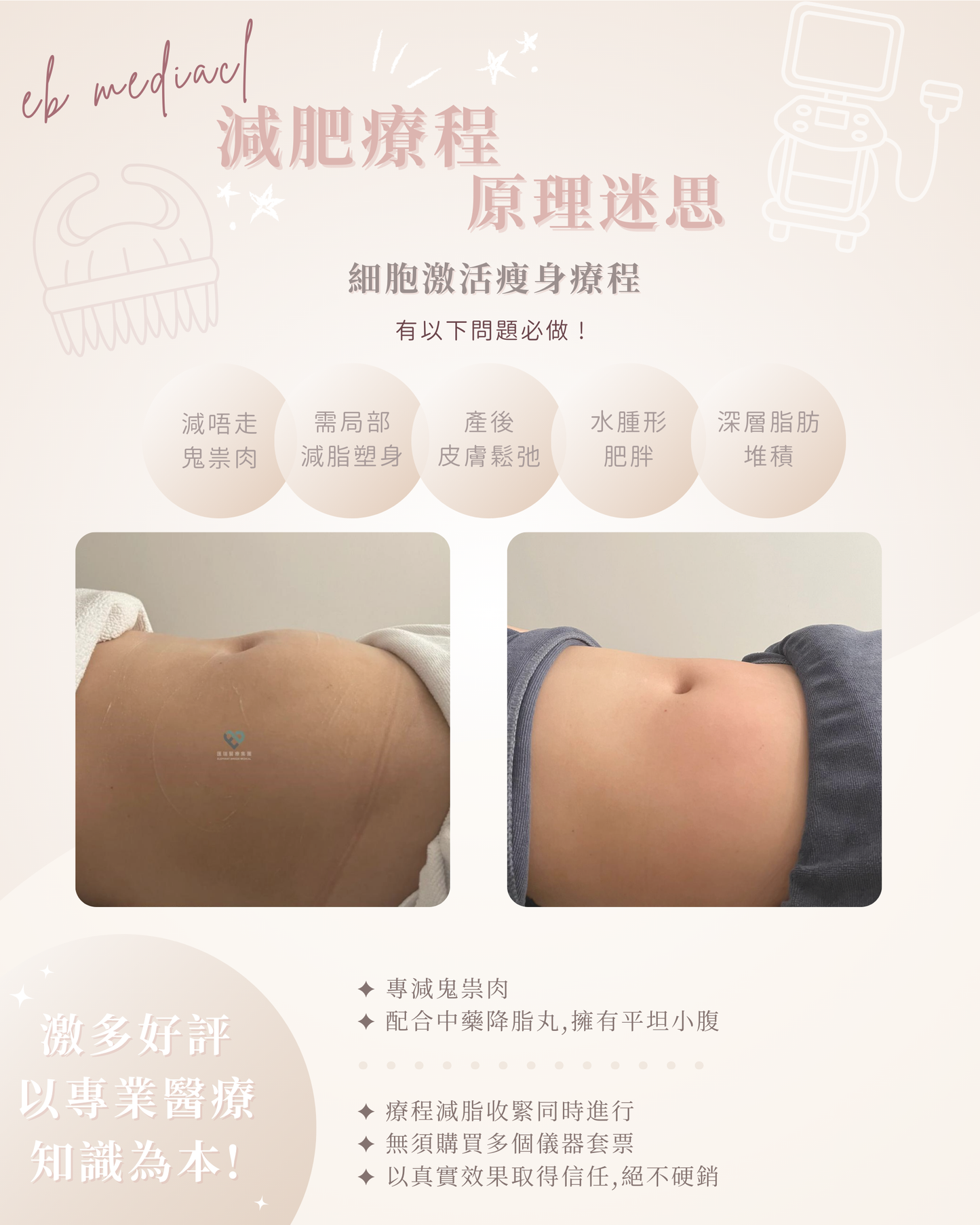 【FDA認證】細胞激活瘦身療程