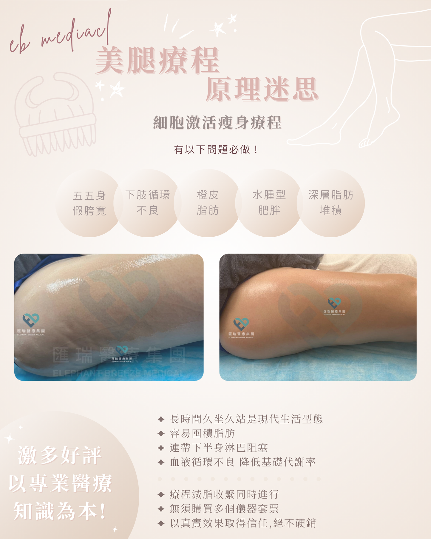 【FDA認證】細胞激活瘦身療程