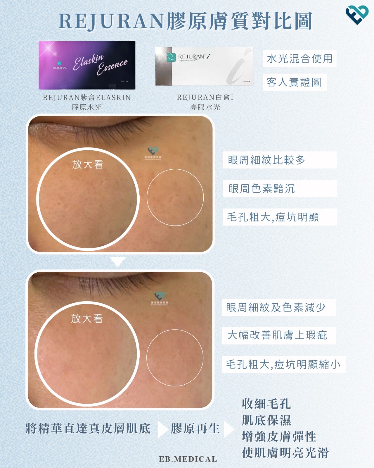 【水光針】REJURAN紫盒