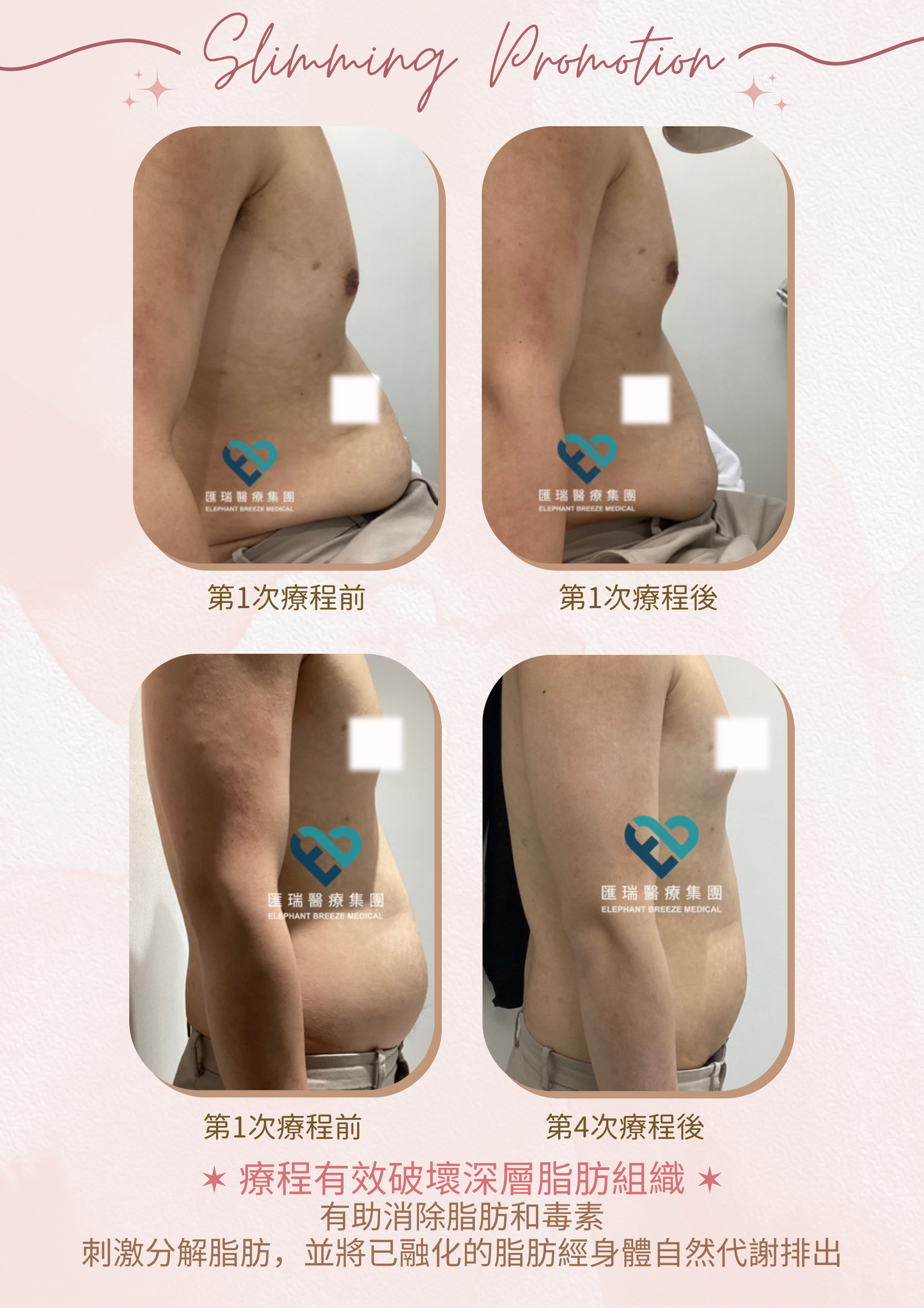 【FDA認證】細胞激活瘦身療程